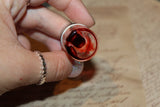 Pulled out Bloody Teeth Specimen Jar