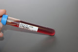 Simulated Blood in Urine Medical Specimen Tube