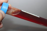 Simulated Blood in Urine Medical Specimen Tube