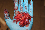 Brain Matter/Tissue