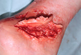 Skin Peeling Back Wound Prosthetic