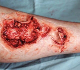 Gorey Prosthetics Bundle