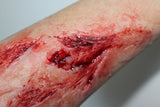 Arm Lacerations Prosthetic