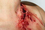 Deep Neck Wound Prosthetic