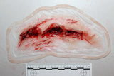 Deep Neck Wound Prosthetic