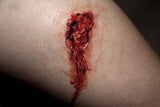 Thigh Laceration Prosthetic