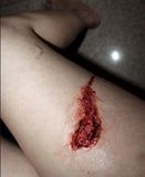 Thigh Laceration Prosthetic