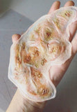 Infected/Burn Wound Prosthetics Bundle
