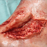 Skin Peeling Back Wound Prosthetic