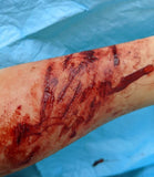 Knife/Stab Wound Prosthetic Bundle