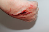 Small Shallow Laceration Prosthetic