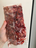 Brain Matter/Tissue