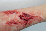 Arm Lacerations Prosthetic