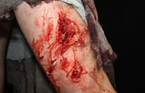Deep Leg Lacerations Prosthetic