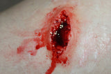Stab Wound Prosthetic