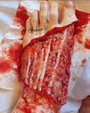 Exposed Ligaments Prosthetic Bundle