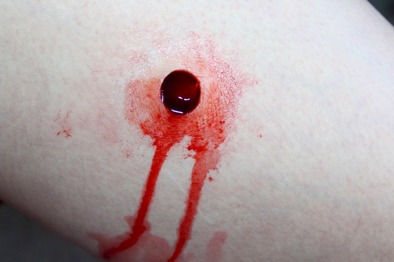 bullet wound scar