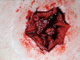Exit Bullet Wound Prosthetic