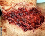 Trauma Wounds Prosthetic Bundle