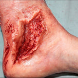 Trauma Wounds Prosthetic Bundle