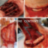 Skinned Alive Prosthetic Bundle