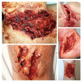 Trauma Wounds Prosthetic Bundle