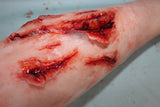 Deep Leg Lacerations Prosthetic
