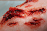 Deep Leg Lacerations Prosthetic