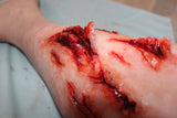 Deep Leg Lacerations Prosthetic