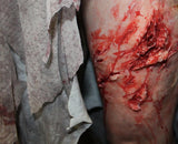 Deep Leg Lacerations Prosthetic