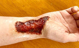 Skin Burn Prosthetic