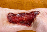 Skin Burn Prosthetic