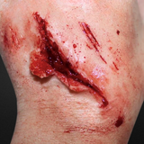 Shallow Laceration Prosthetic