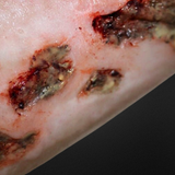 Infected Zombie Burn Wound Prosthetic