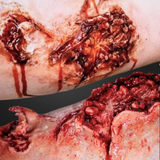 Dog Bite Wound Prosthetic