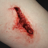 Laceration Wound Prosthetic