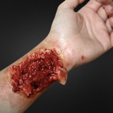 Torn Wrist Prosthetic