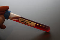 Simulated Blood in Urine Medical Specimen Tube