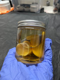 Preserved Toe Specimens Jar