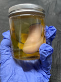 Preserved Toe Specimens Jar