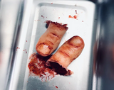Severed Toe Prop