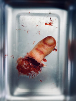Severed Toe Prop