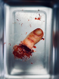 Severed Toe Prop
