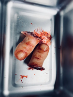 Severed Toe Prop