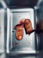 Severed Toe Prop
