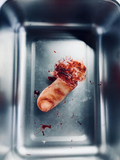 Severed Toe Prop
