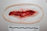 Simple Wound Prosthetic