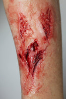 Arm Lacerations Prosthetic