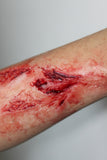 Arm Lacerations Prosthetic