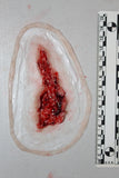 Thigh Laceration Prosthetic